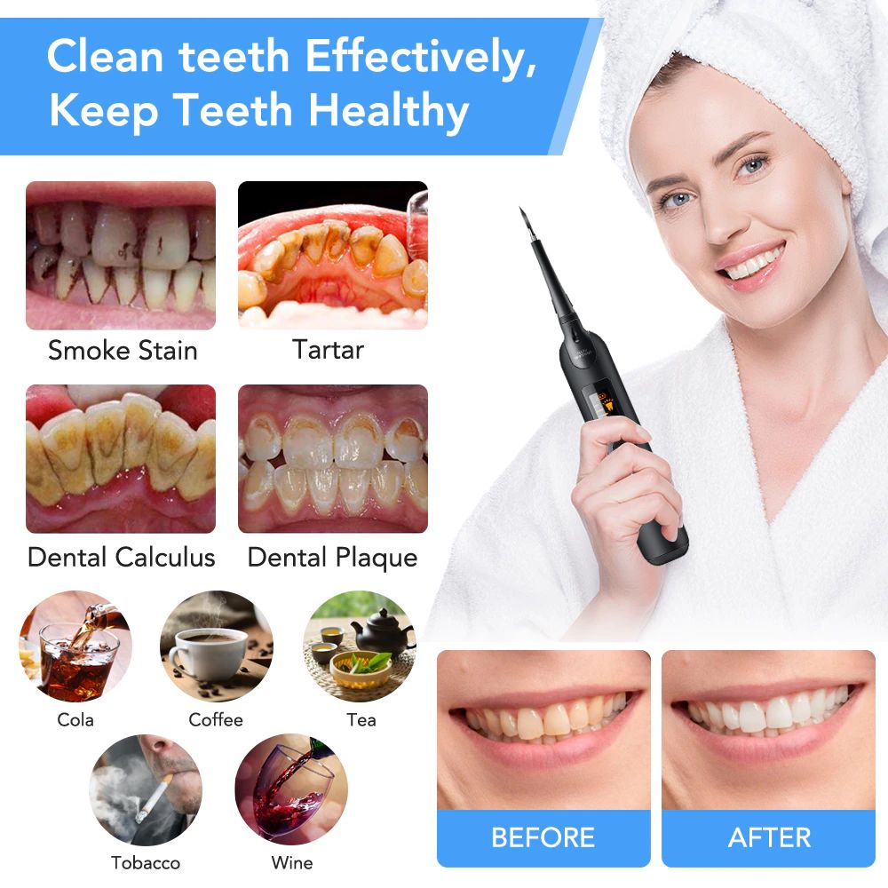 electric sonic tooth cleaner with led display 4